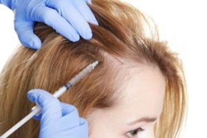Female Hair Loss Treatment