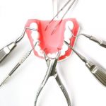 Reshape Your Smile with Invisalign in Clapham