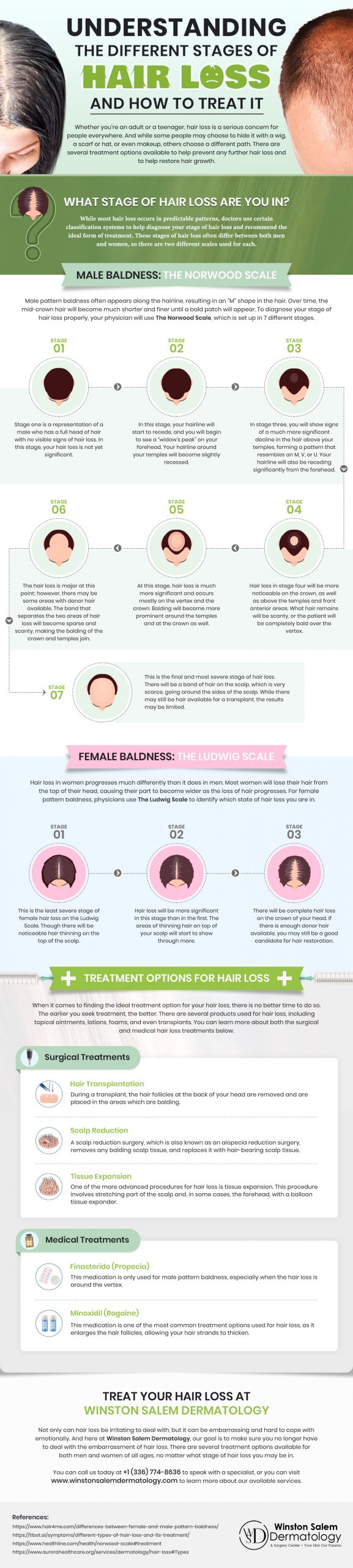 Understanding the Different Stages of Hair Loss and How to Treat It